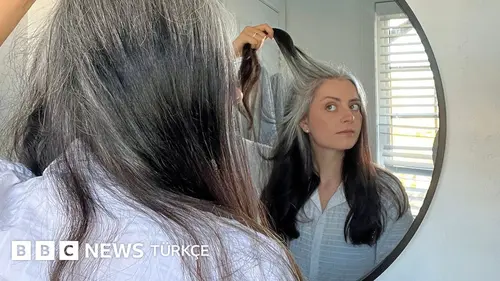 Saçın erken beyazlamasının nedenleri ne, geri döndürmek mümkün mü?